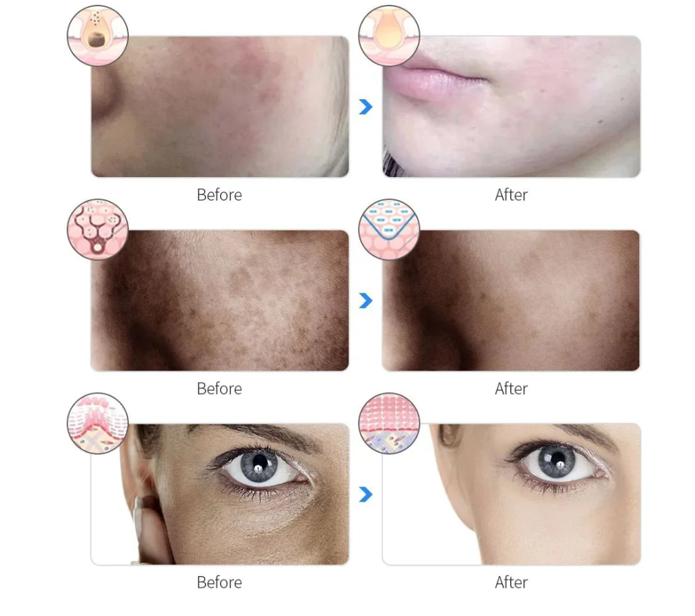 RadiantGlo LED face mask