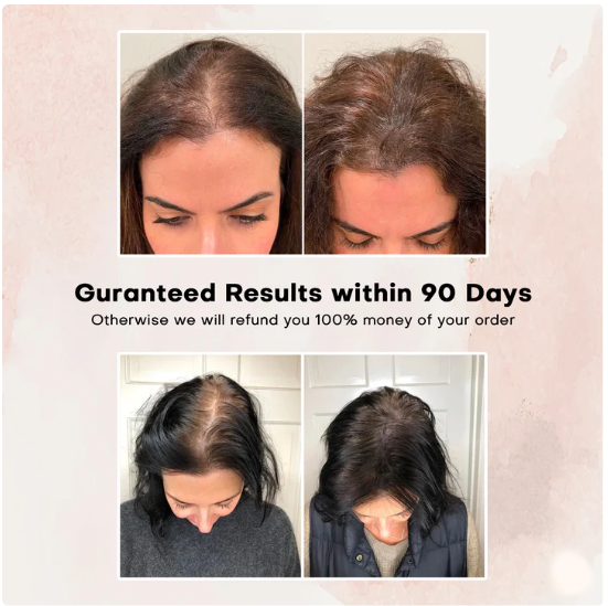 Lumera Led hair Therapy Brush