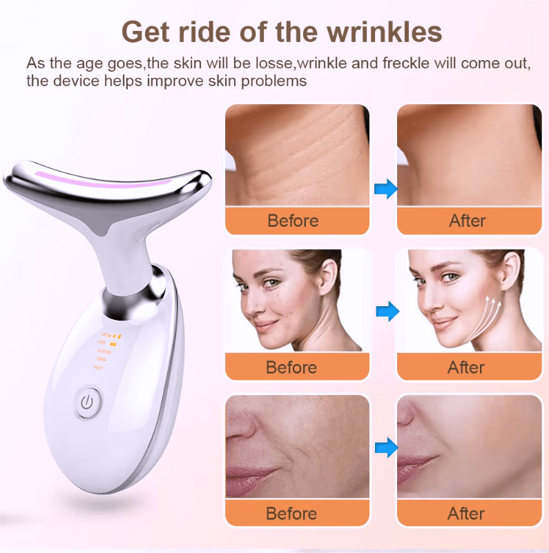 Lumera Double chin and wrinkle removal device